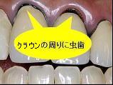 図1