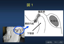 図1