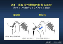 図4