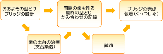 補綴歯科ってなに 補綴歯科ってなに